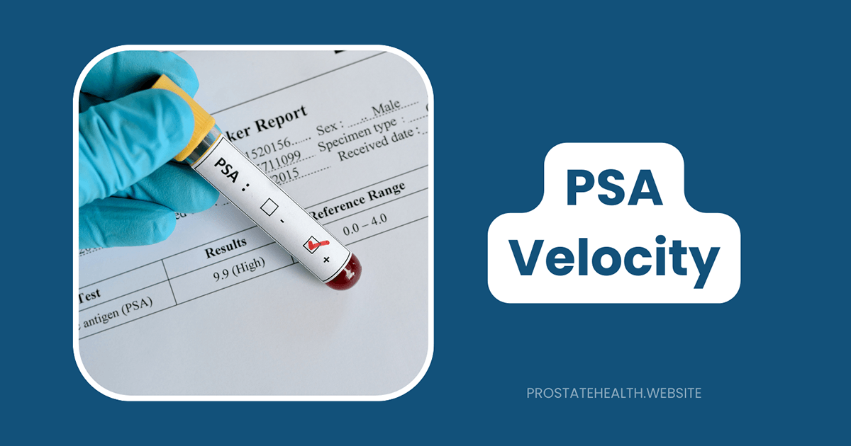 PSA velocity