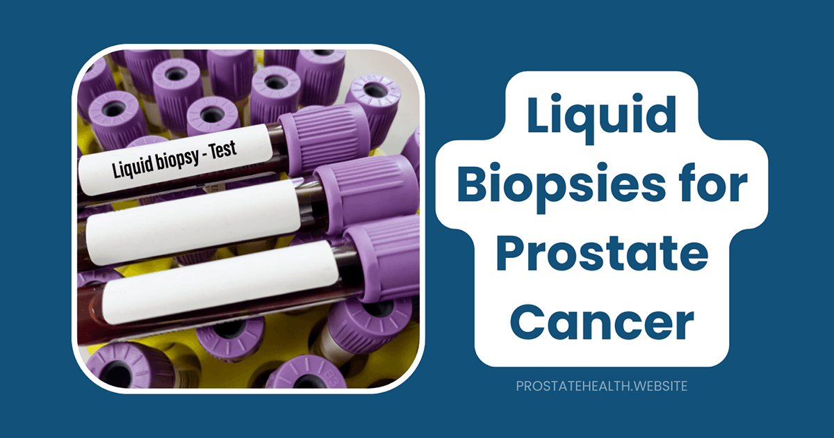 liquid biopsies for prostate cancer